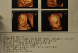 8周胎儿b超图（8周胎儿b超图片）