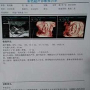 怀孕11周胎儿图片欣赏（怀孕11周胎儿稳定了吗?多少周才能稳定）