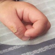 宝宝3个月了，吃手的频率越来越多，请问怎样能缓解,胎儿3个月图片大全