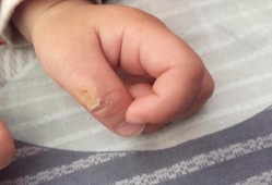 宝宝3个月了，吃手的频率越来越多，请问怎样能缓解,胎儿3个月图片大全