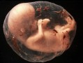 怀孕11周胎儿图片（怀孕11周，胎儿头臀长48正常吗）