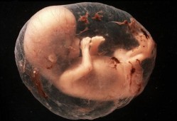 怀孕11周胎儿图片（怀孕11周，胎儿头臀长48正常吗）