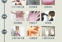 孕期湿气太重怎么除（孕期湿气太重怎么除湿）
