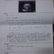 胎儿双肾大小标准值（胎儿双肾大小标准值是多少）