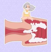 孕妇念珠菌性阴道炎怎么办,孕期念珠菌性阴炎会影响胎儿吗