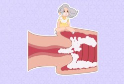 孕妇念珠菌性阴道炎怎么办,孕期念珠菌性阴炎会影响胎儿吗