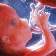 怀孕五个月怎么能死胎？孕妇怎样预防死胎呢,人为死胎的方法