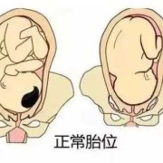 胎儿头不正（胎儿头不正）