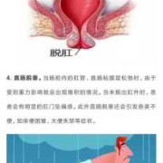孕期肛门坠胀（孕期肛门坠胀感是怎么回事）