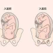 胎头衔接的标准,胎儿未衔接是什么意思