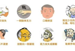 孕期脑供血不足的症状（孕期脑供血不足的症状有哪些）