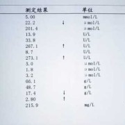 血清检查都能查出什么病,孕期血清检查什么时候做合适