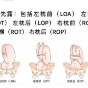 胎儿左枕横位男孩多（胎位LOT是什么意思啊，胎位正吗?能否顺产）