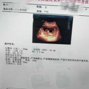 胎儿nt值多少是男孩（胎儿NT值多少是男孩女孩）