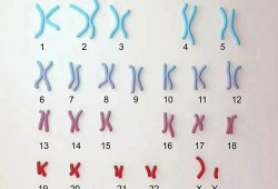 15号染色体缺失会怎样,胎儿15号染色体异常会怎样