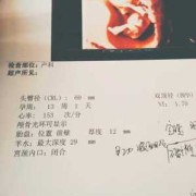 胎儿估重B（胎儿估重B）