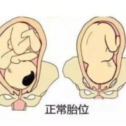 孕28周胎儿头在哪（孕28周胎儿头在哪里）