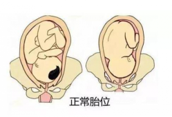 孕28周胎儿头在哪（孕28周胎儿头在哪里）