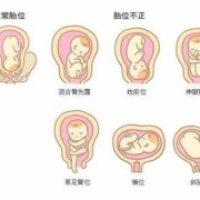胎膜早破有什么症状,胎膜早破分泌物图片