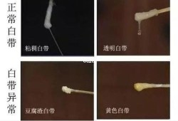 孕期白带水状（怀孕4个多月早上起来下面湿湿的感觉和流水似的，是怎么回事）