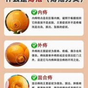 怀孕期间有痔疮怎么治（孕期得痔疮怎么治疗呢）