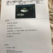 孕期彩超数据（刚刚给胎儿做了心脏彩超检查，结果的数据是多少标准的呢）