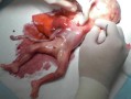引产后的胎儿怎么处理（医院引产后的胎儿怎么处理）