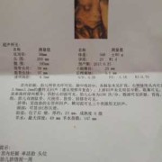 胎儿头部囊肿会自己消失吗（四维彩超胎儿脑部囊肿怎么办）
