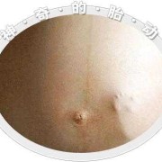 畸形胎儿胎动会频繁吗,畸形胎儿会胎动吗视频