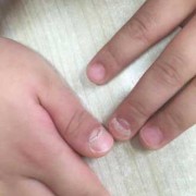 胎宝宝几周开始长指甲,胎儿指甲长会划破羊膜吗