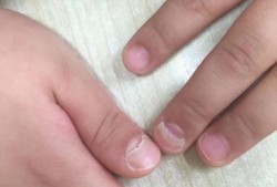 胎宝宝几周开始长指甲,胎儿指甲长会划破羊膜吗