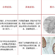 孕期有霉菌是生女孩吗（孕期有霉菌是生女孩吗还是男孩）
