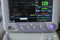 家用胎心监护仪对胎儿有影响吗（家用胎心监护仪对胎儿有影响吗 知乎）
