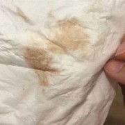 怀孕期间出血正常吗（女人怀孕期间出血正常吗）