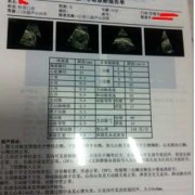 视频彩铃心动会员收费吗,胎儿超声心动多少钱