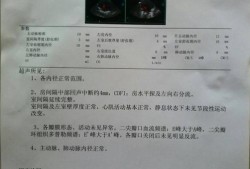 胎儿背向右（八个月宝宝体检心脏彩超诊断结果说房间隔水平左向右分流）