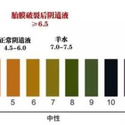 羊水ph值正常是多少,孕期ph值偏高怎么办