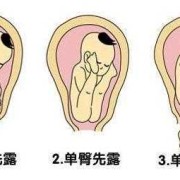 32周胎儿的头在哪里?怀孕32周，臀位怎么办,孕妇32周胎儿图片