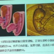 胎儿脐（胎儿脐膨出是什么原因导致的呢）