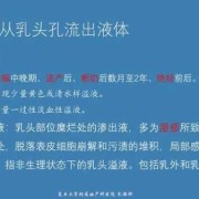 孕期乳房溢乳（孕期乳房溢乳是什么原因）