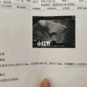 孕期宫颈测定（孕期宫颈测定是检查什么）