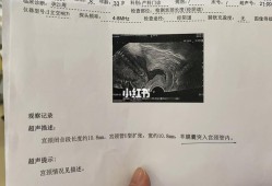 孕期宫颈测定（孕期宫颈测定是检查什么）