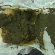 3个月的宝宝大便绿色黏黏的果冻状是怎么回事,3个月胎儿图片
