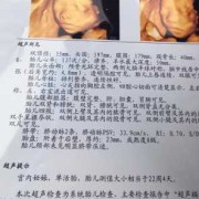 四维彩超官宣文案,四维彩超胎儿照片分得出男女吗?