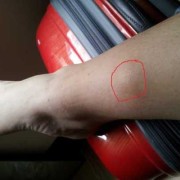 孕期小腿硬（孕期小腿硬邦邦是怎么回事）
