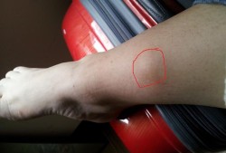 孕期小腿硬（孕期小腿硬邦邦是怎么回事）