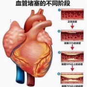 胎儿心脏血管异常原因（心脏多一根血管，要怎么办）