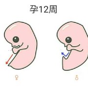 胎儿性别是（胎儿性别是）