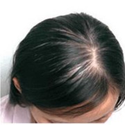 孕妇掉头发厉害的原因有哪些,孕期老掉头发什么原因