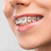 孕期可以矫正牙齿吗（孕期可以矫正牙齿吗?）